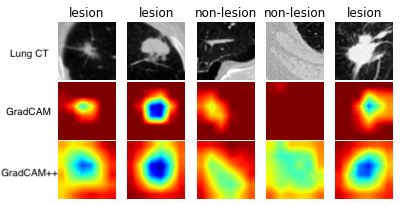 CAM visualization example